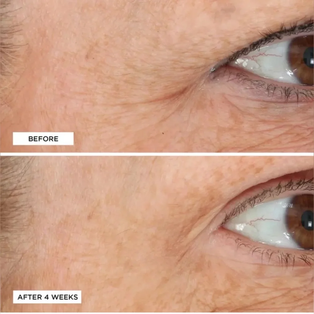 SOLD TO PVT PARTY… Perricone MD Acyl-Glutathione Eyelid Lift Serum w/FREE GIFT 🎁 - Picture 4 of 5